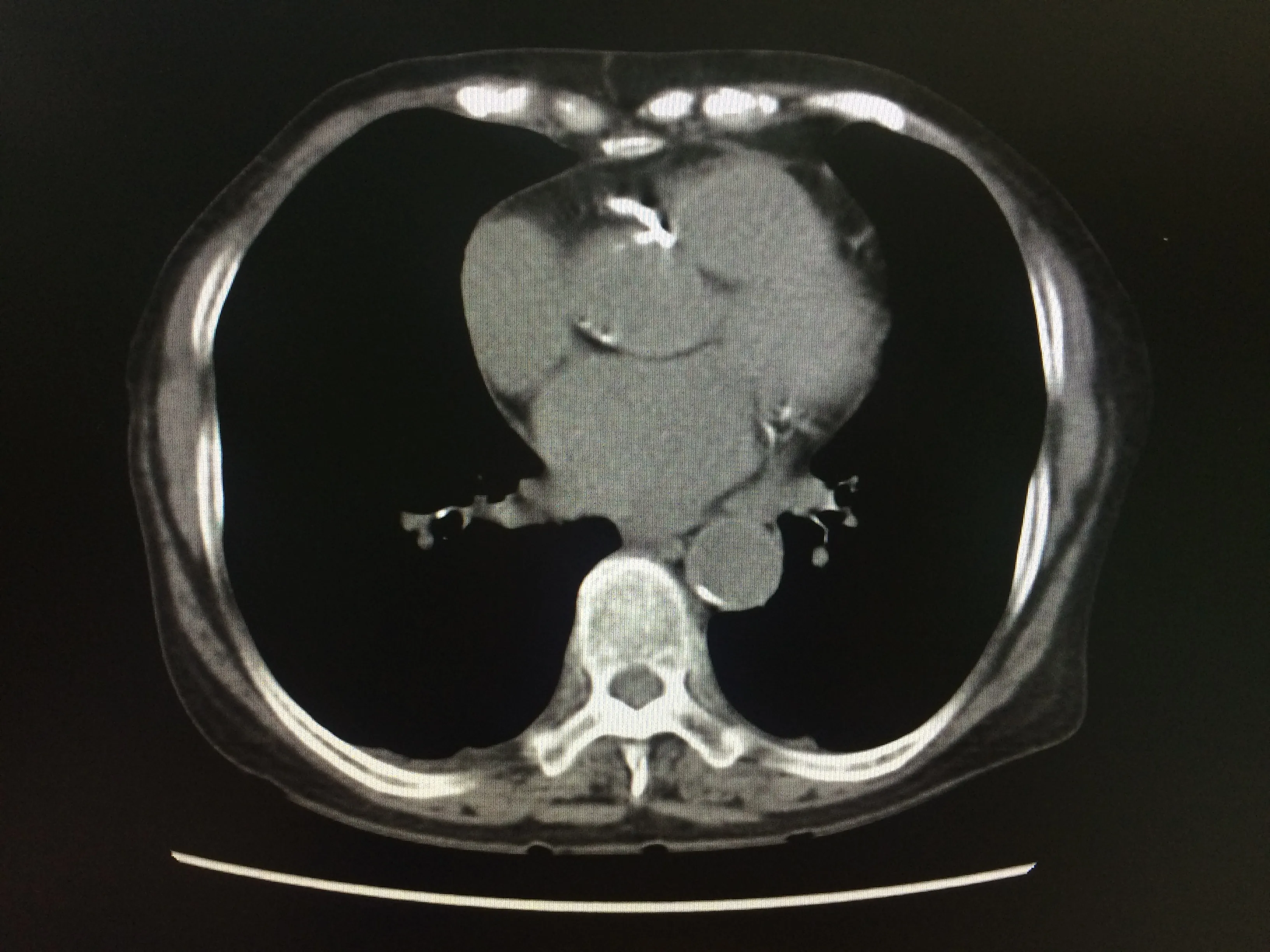 Detailed imaging visualization